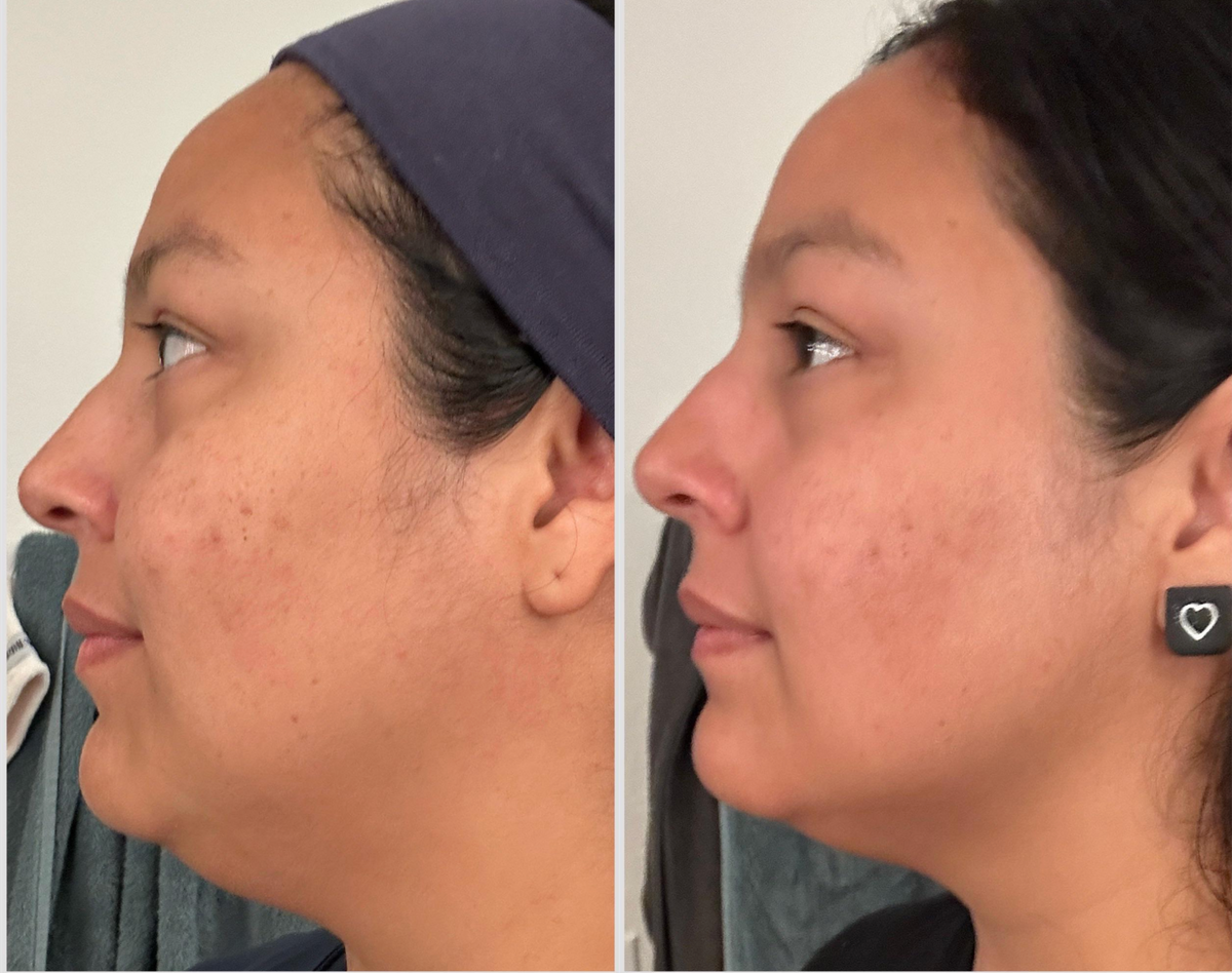 Before and after